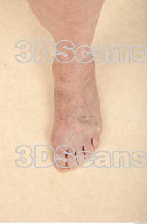 Photo reference of foot 0001